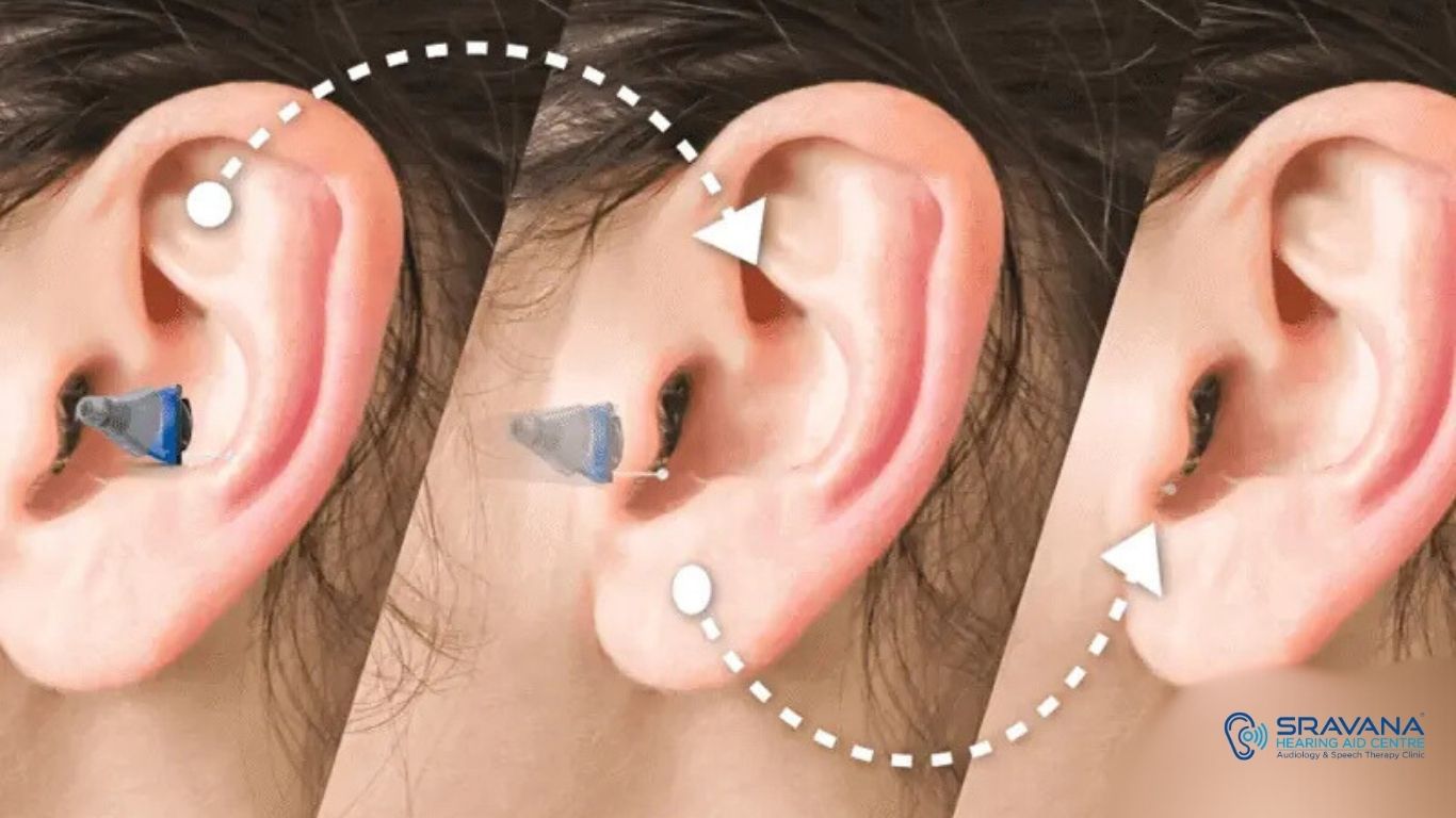 Future of Hearing Aids